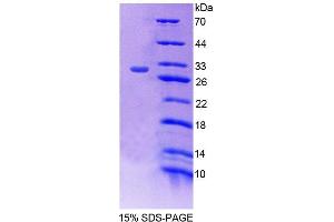 SDS-PAGE (SDS) image for Propionyl CoA Carboxylase beta Polypeptide (PCCB) (AA 311-541) protein (His tag) (ABIN6239499) (PCCB Protein (AA 311-541) (His tag))
