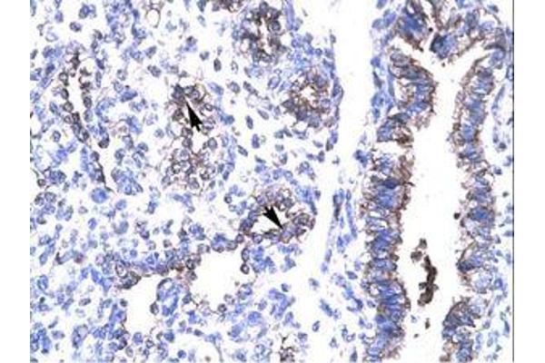 HIV-1 Tat Interactive Protein 2, 30kDa (HTATIP2) (AA 30-79) Antikörper