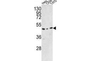 Western Blotting (WB) image for anti-Chromosome 9 Open Reading Frame 156 (C9orf156) antibody (ABIN3002894) (C9orf156 Antikörper)