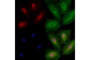 ABIN6257561 and ABIN6274179 staining  cells by IF/ICC. (ZNF18 Antikörper  (C-Term))