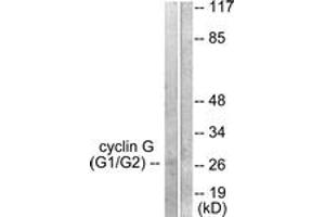 Western blot analysis of extracts from Jurkat cells, using Cyclin G Antibody. (Cyclin G1 Antikörper  (AA 161-210))
