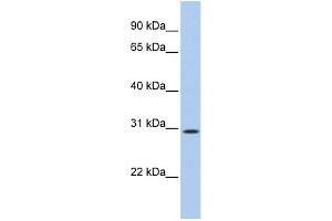 WB Suggested Anti-C20orf10 Antibody Titration: 0. (TP53TG5 Antikörper  (N-Term))