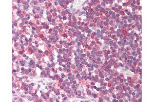 Anti-FTHFSDC1 / MTHFD1L antibody IHC staining of human tonsil. (MTHFD1L Antikörper  (AA 578-591))