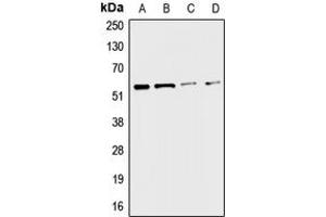 Western blot analysis of CHRNA3 expression in A549 (A), HepG2 (B), mouse liver (C), rat kidney (D) whole cell lysates. (CHRNA3 Antikörper  (Center))