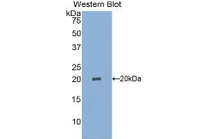 Figure. (SIGLEC14 Antikörper  (AA 24-137))