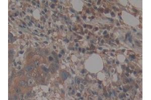 Immunohistochemistry (IHC) image for anti-Telomerase-Associated Protein 1 (TEP1) (AA 2368-2627) antibody (ABIN7432034)