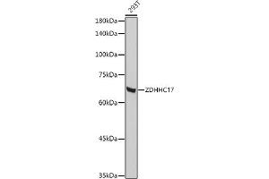 Western blot analysis of extracts of 293T cells, using ZDHHC17 antibody (ABIN6130455, ABIN6150416, ABIN6150417 and ABIN6222540) at 1:1000 dilution. (ZDHHC17 Antikörper  (AA 170-310))