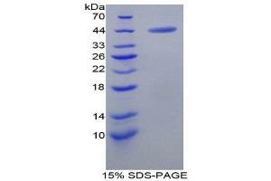 SDS-PAGE (SDS) image for Gastrin (GAST) (AA 1-104) protein (His tag,GST tag) (ABIN2122895) (Gastrin Protein (GAST) (AA 1-104) (His tag,GST tag))