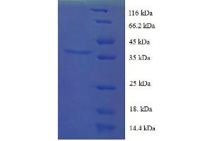 Follicle Stimulating Hormone, beta Polypeptide (FSHB) (AA 19-129) protein (His tag) expressed in E.