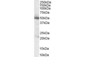 Image no. 1 for anti-Pancreatic and Duodenal Homeobox 1 (PDX1) (C-Term) antibody (ABIN374551) (PDX1 Antikörper  (C-Term))
