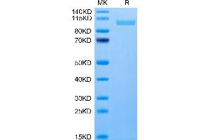 Human Integrin alpha 2B beta 3 (ITGA2B&ITGB3) Heterodimer on Tris-Bis PAGE under reduced condition. (Integrin alpha 2B beta 3 (ITGA2B & ITGB3) Heterodimer (AA 32-993) protein (His tag))