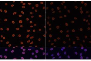Immunofluorescence analysis of C6 cells using Acetyl-Histone H4-K12 Polyclonal Antibody at dilution of 1:100. (Histone H4 Antikörper  (acLys12))