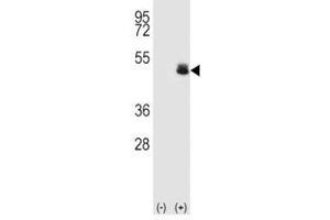 Western blot analysis of PAX-6 antibody and 293 cell lysate (2 ug/lane) either nontransfected (Lane 1) or transiently transfected (2) with the human gene. (PAX6 Antikörper  (AA 352-380))