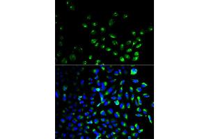 Immunofluorescence analysis of HeLa cell using UCHL1 antibody. (UCHL1 Antikörper)