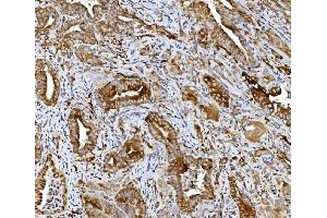 IHC analysis of PDIA5 using anti-PDIA5 antibody (ABIN7601801). (PDIA5 Antikörper  (AA 46-481))