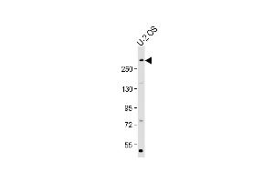 Anti-E at 1:2000 dilution + U-2 OS whole cell lysate Lysates/proteins at 20 μg per lane. (p300 Antikörper  (Ser1834))
