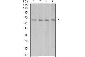 Western Blotting (WB) image for anti-Vascular Endothelial Growth Factor A (VEGFA) (AA 207-371) antibody (ABIN5879821) (VEGFA Antikörper  (AA 207-371))