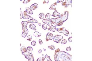 IHC analysis of RP2 using anti-RP2 antibody (ABIN6719513). (RP2 Antikörper  (AA 244-348))