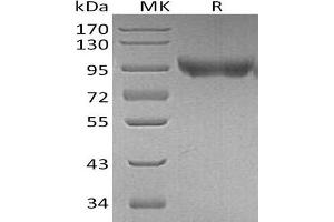 Western Blotting (WB) image for Platelet/endothelial Cell Adhesion Molecule (PECAM1) protein (His tag) (ABIN7320792)