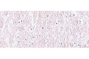 Immunohistochemistry of paraffin-embedded Human brain tissue using SMPD2 Polyclonal Antibody at dilution of 1:90(x200) (SMPD2 Antikörper)