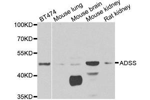 Western blot analysis of extracts of various cell lines, using ADSS antibody. (ADSS Antikörper)