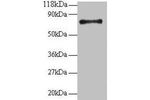 Western blot All lanes: RPS18 antibody at 2 μg/mL + 293T whole cell lysate Secondary Goat polyclonal to rabbit IgG at 1/15000 dilution Predicted band size: 18 kDa Observed band size: 75 kDa (RPS18 Antikörper  (AA 2-152))