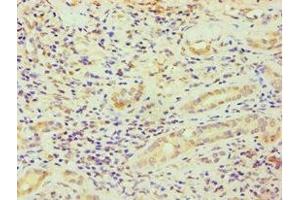 Immunohistochemistry of paraffin-embedded human kidney tissue using ABIN7164363 at dilution of 1:100 (DDX5 Antikörper  (AA 1-290))