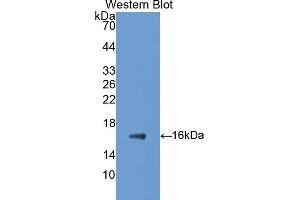 Detection of Recombinant GAD1, Rat using Polyclonal Antibody to Glutamate Decarboxylase 1, Brain (GAD1) (GAD Antikörper  (AA 1-97))