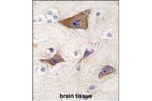 Immunohistochemistry (Paraffin-embedded Sections) (IHC (p)) image for anti-Leucine-Rich Repeat Containing G Protein-Coupled Receptor 5 (LGR5) (AA 443-473) antibody (ABIN389219)