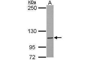 WB Image Sample (30 ug of whole cell lysate) A: MCF-7 5% SDS PAGE antibody diluted at 1:1000 (NLRC4 Antikörper  (N-Term))