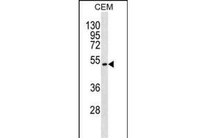 TOM1L2 Antibody (C-term) (ABIN1537379 and ABIN2850138) western blot analysis in CEM cell line lysates (35 μg/lane). (TOM1L2 Antikörper  (C-Term))