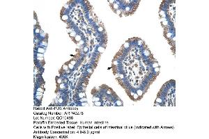 Rabbit Anti-FUS Antibody  Paraffin Embedded Tissue: Human Intestine Cellular Data: Epithelial cells of intestinal villas Antibody Concentration: 4. (FUS Antikörper  (N-Term))