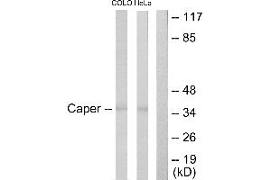 Immunohistochemistry analysis of paraffin-embedded human brain tissue using Caper antibody. (RBM39 Antikörper  (Internal Region))