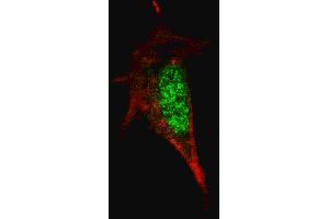 Fluorescent confocal image of SY5Y cells stained with SOX2 antibody. (SOX2 Antikörper)