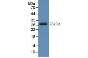 Detection of Recombinant PDXK, Rat using Polyclonal Antibody to Pyridoxal Kinase (PDXK) (PDXK Antikörper  (AA 35-251))