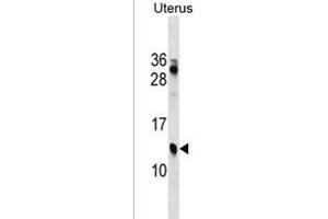 KLKP1 Antibody (N-term) (ABIN1538887 and ABIN2850264) western blot analysis in Uterus tissue lysates (35 μg/lane). (KLKP1 Antikörper  (N-Term))
