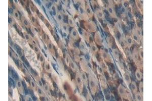 Detection of GPX4 in Mouse Stomach Tissue using Polyclonal Antibody to Glutathione Peroxidase 4 (GPX4)