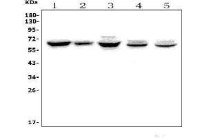 Western blot analysis of ANGPT2 using anti-ANGPT2 antibody (ABIN7601450).