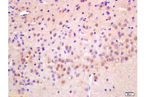 Formalin-fixed and paraffin embedded rat brain labeled with Anti-RAD21 Polyclonal Antibody, Unconjugated (ABIN706391) at 1:200 followed by conjugation to the secondary antibody and DAB staining. (RAD21 Antikörper  (AA 531-631))