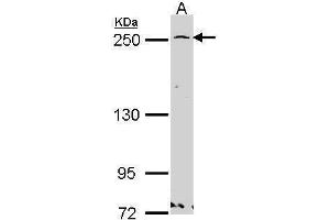 WB Image Sample (30 ug of whole cell lysate) A: Hela 5% SDS PAGE GBF1 antibody antibody diluted at 1:1000 (GBF1 Antikörper  (N-Term))