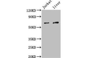 Western Blot Positive WB detected in: Jurkat whole cell lysate, Mouse liver tissue All lanes: KLHL2 antibody at 3 μg/mL Secondary Goat polyclonal to rabbit IgG at 1/50000 dilution Predicted band size: 66, 67, 57 kDa Observed band size: 66, 67 kDa (KLHL2 Antikörper  (AA 1-155))