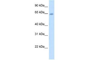 WB Suggested Anti-STS Antibody Titration:  5. (STS Antikörper  (C-Term))
