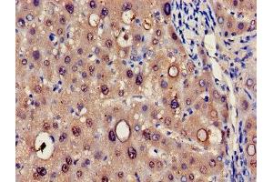 Immunohistochemistry of paraffin-embedded human liver tissue using ABIN7142154 at dilution of 1:100 (HRSP12 Antikörper  (AA 2-137))