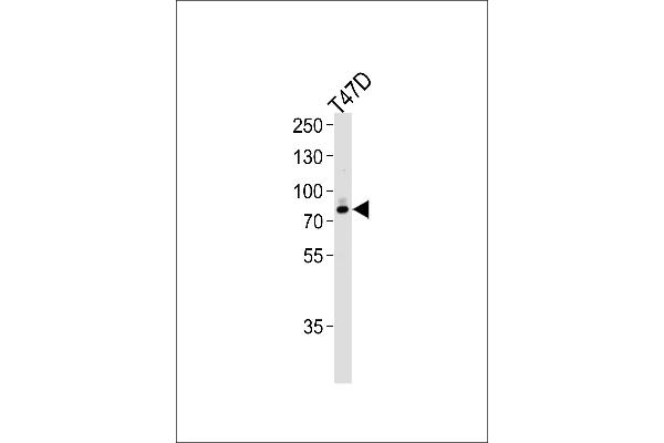EXT2 Antikörper  (AA 182-209)