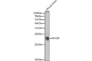 Western blot analysis of extracts of Mouse brain using RHOB Polyclonal Antibody at dilution of 1:1000. (RHOB Antikörper)