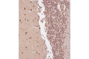 Immunohistochemistry (Paraffin-embedded Sections) (IHC (p)) image for anti-ELAV (Embryonic Lethal, Abnormal Vision, Drosophila)-Like 2 (Hu Antigen B) (ELAVL2) (AA 156-184) antibody (ABIN656861)