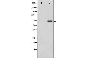 Western blot analysis of Tyrosinase expression in COS7 cells.