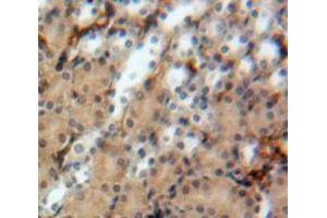 Used in DAB staining on fromalin fixed paraffin-embedded Kidney tissue (Uromodulin Antikörper  (AA 335-590))