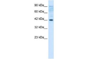 Human Jurkat; Jurkat Whole Cell; ZFP1 antibody - N-terminal region in Human Jurkat cells using Western Blot (Zfp-1 Antikörper  (N-Term))