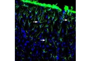 Expression of GFAP in rat brainImmunohistochemical staining of free-floating rat frozen brain sections using Anti-GFAP Antibody (ABIN7043217, ABIN7044273 and ABIN7044274), (1:2000). (Glial Fibrillary Acidic Protein (GFAP) Peptid)
